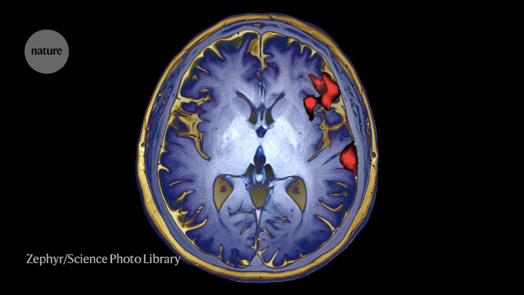 Can brain scans reveal behaviour? Study says not yet