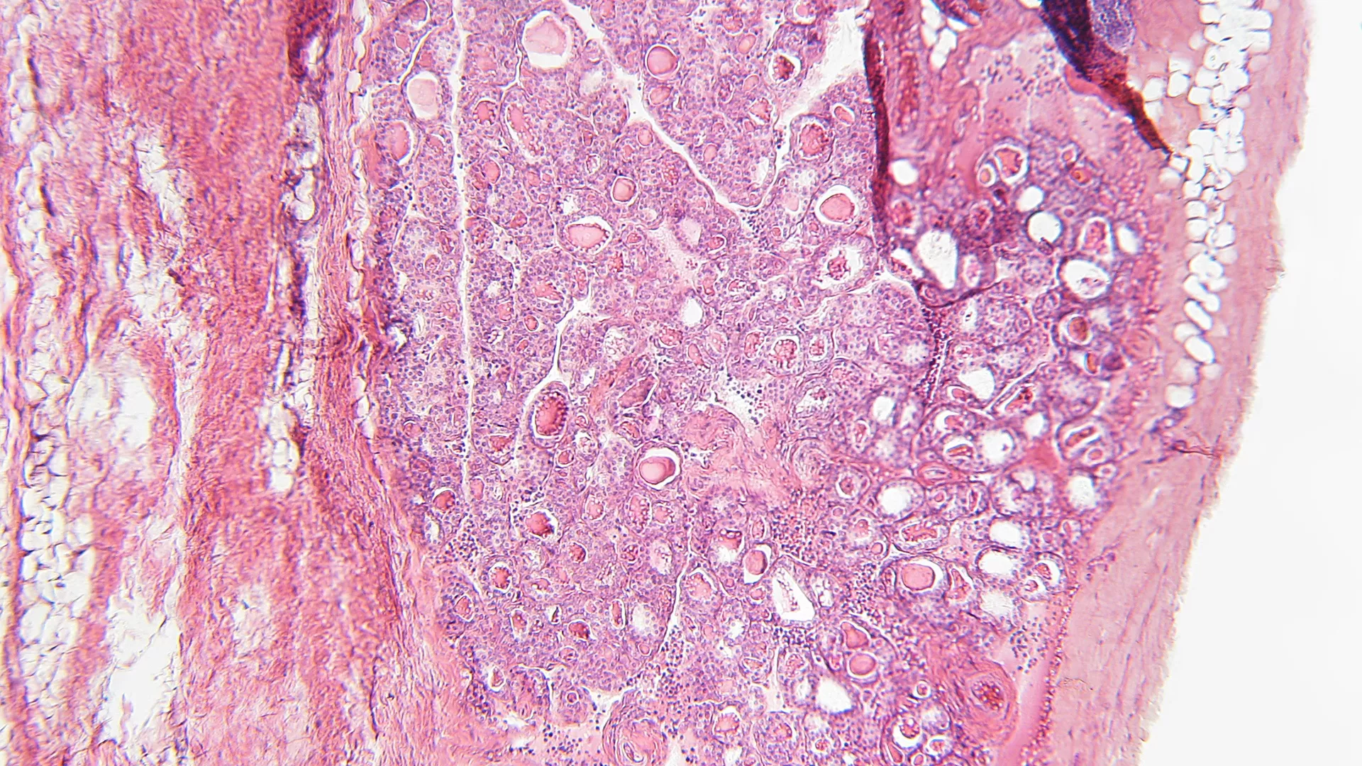 SDR42E1 modulates Vitamin D absorption and cancer pathogenesis