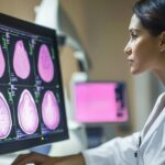 AI misses nearly one-third of breast cancers, study finds